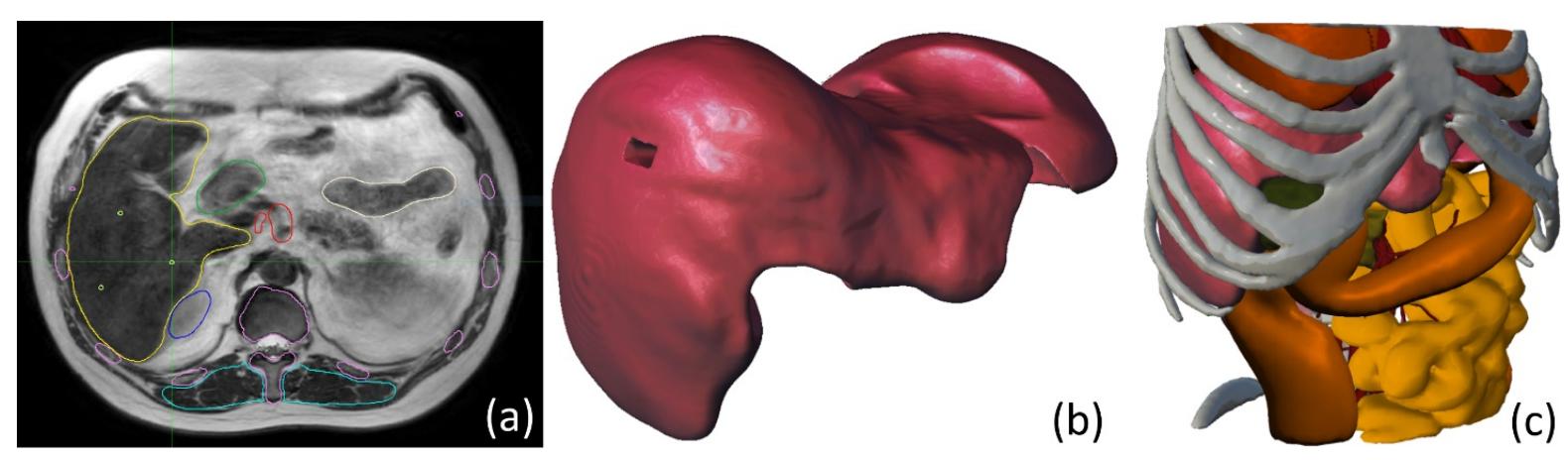3D-Printed Multi-Contrast Phantom for Quality Assurance of Adaptive Radiotherapy Delivery in a High-Field MR-Linac